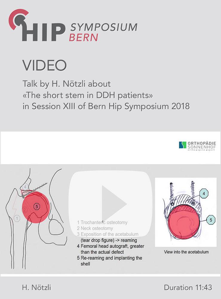 H. Nötzli - The short stem in DDH patients - Hip Symposium 2018