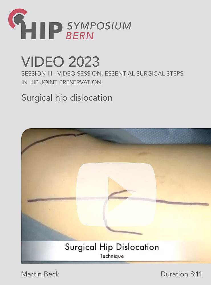 Surgical hip dislocation | Martin Beck (Session 3)