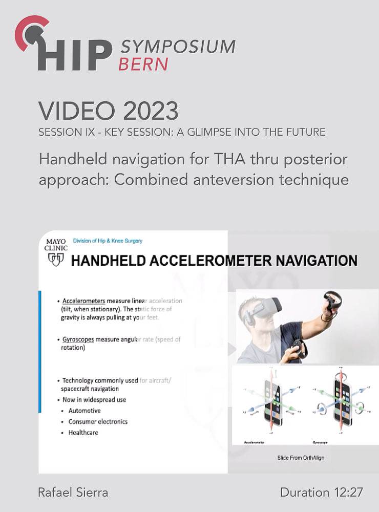 Handheld navigation for THA thru posterior approach: Combined anteversion technique | Rafael Sierra (Session 9)