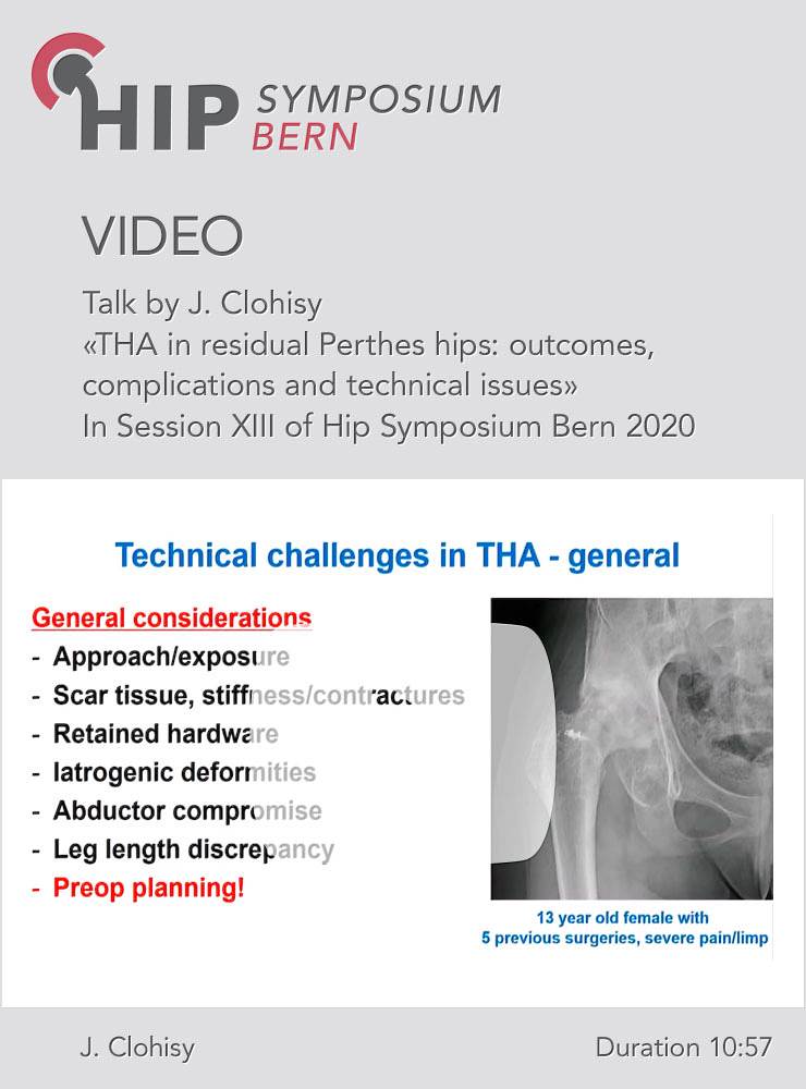 THA in residual Perthes hips: outcomes, complications and technical issues / J. Clohisy