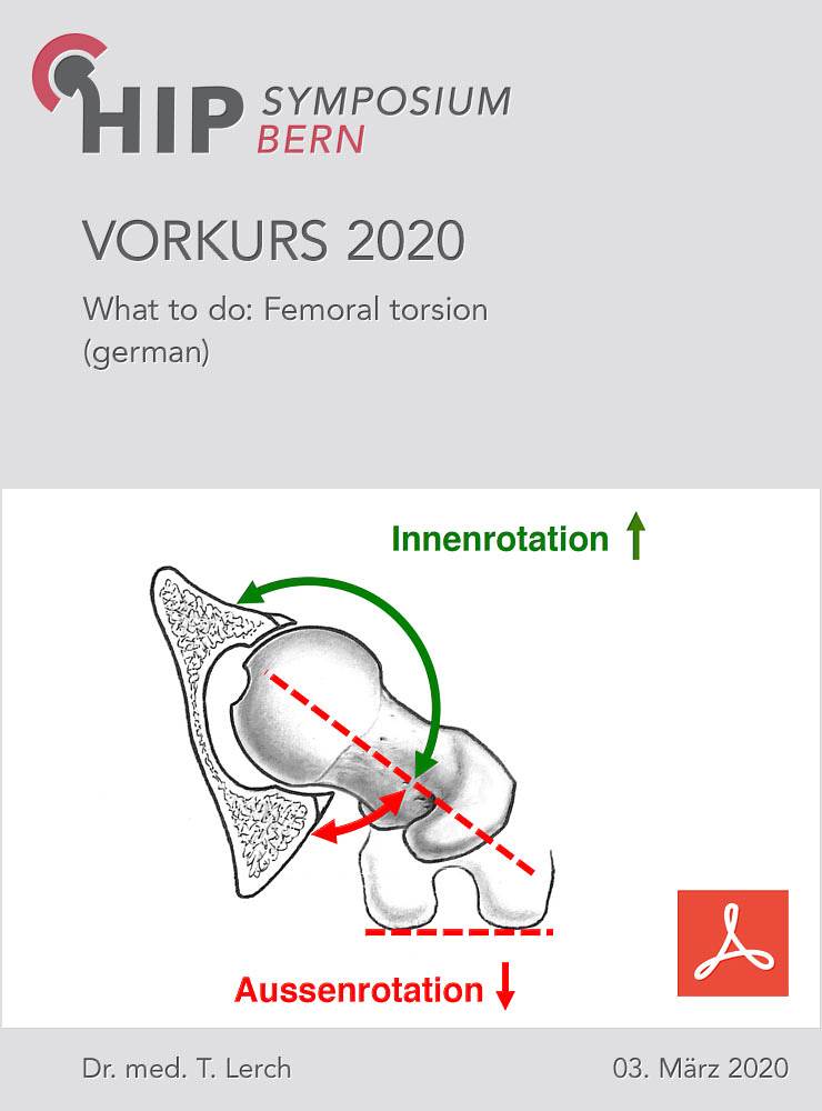 Vorkurs 2020 - Lerch - What to do: Femoral torsion