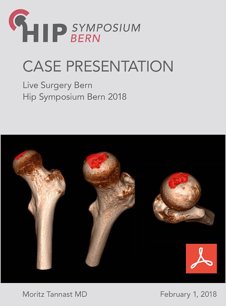 Fallvorstellung Live Surgery Bern