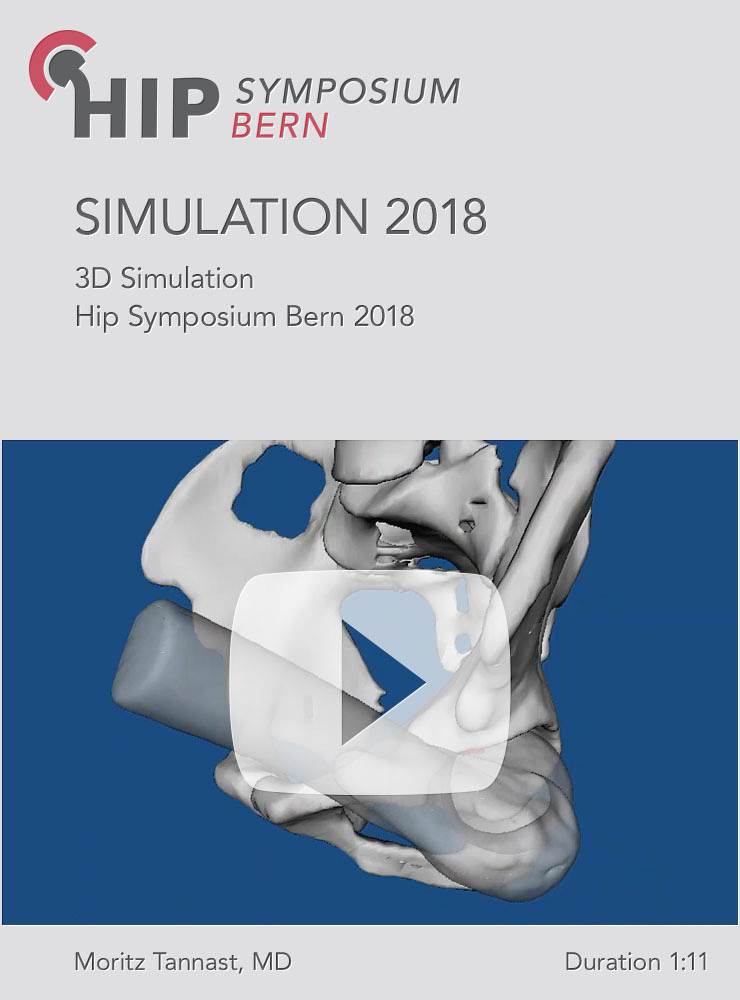 3D Simulation