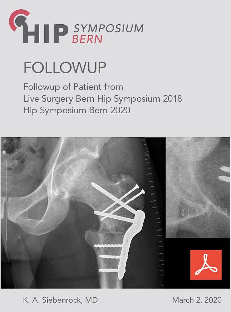 Followup of Patient from Live Surgery Bern Hip Symposium 2018