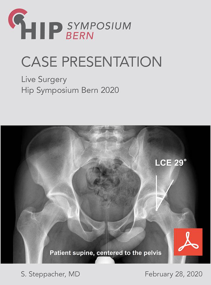 Live Surgery 2020 – Case Presentation