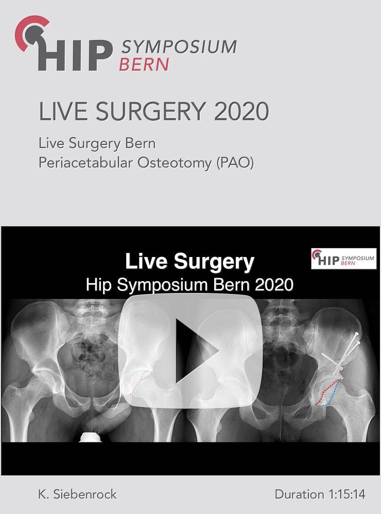 Live Surgery Hip Symposium 2020 / K. Siebenrock