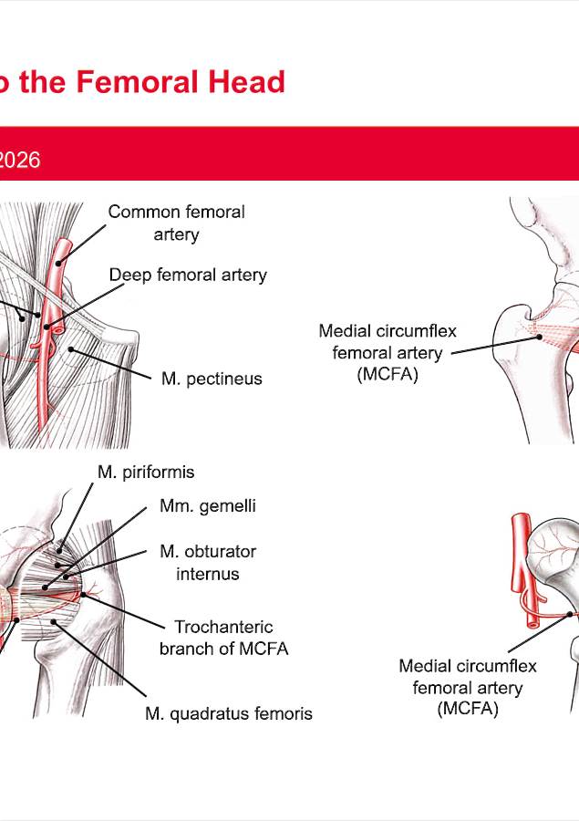 Poster Blood Supply To The Femoral Head Hip Sympo