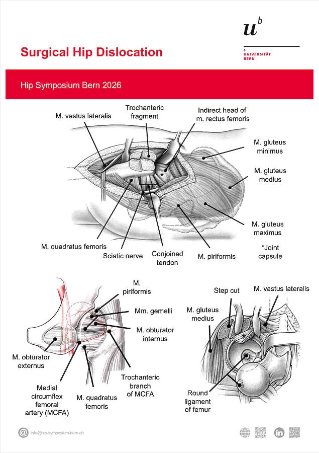 Poster Surgical Hip Dislocation Bern Hip Symposium