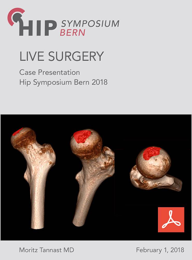 Fallvorstellung Live Surgery Bern