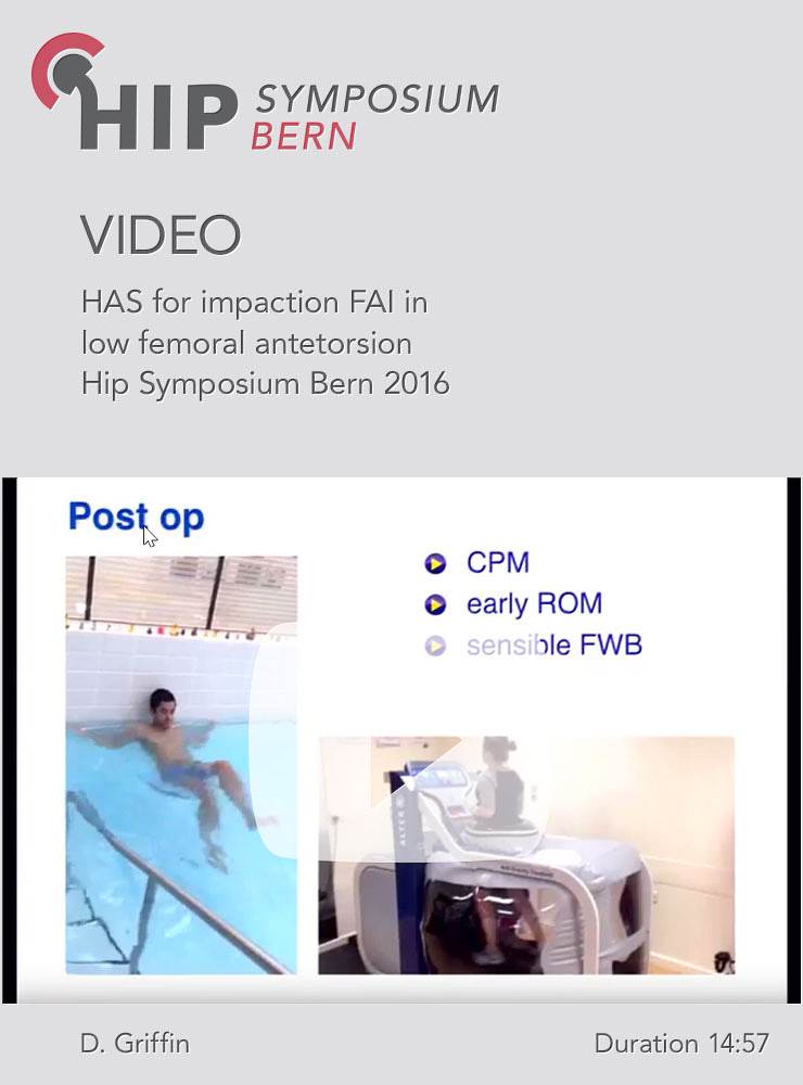 D. Griffin - HAS for impaction FAI in low femoral antetorsion - Hip Symposium 2016