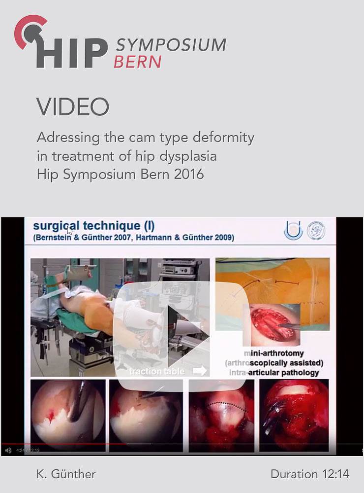 K. Günther - Adressing the cam type deformity in treatment of hip dysplasia - Hip Symposium 2016