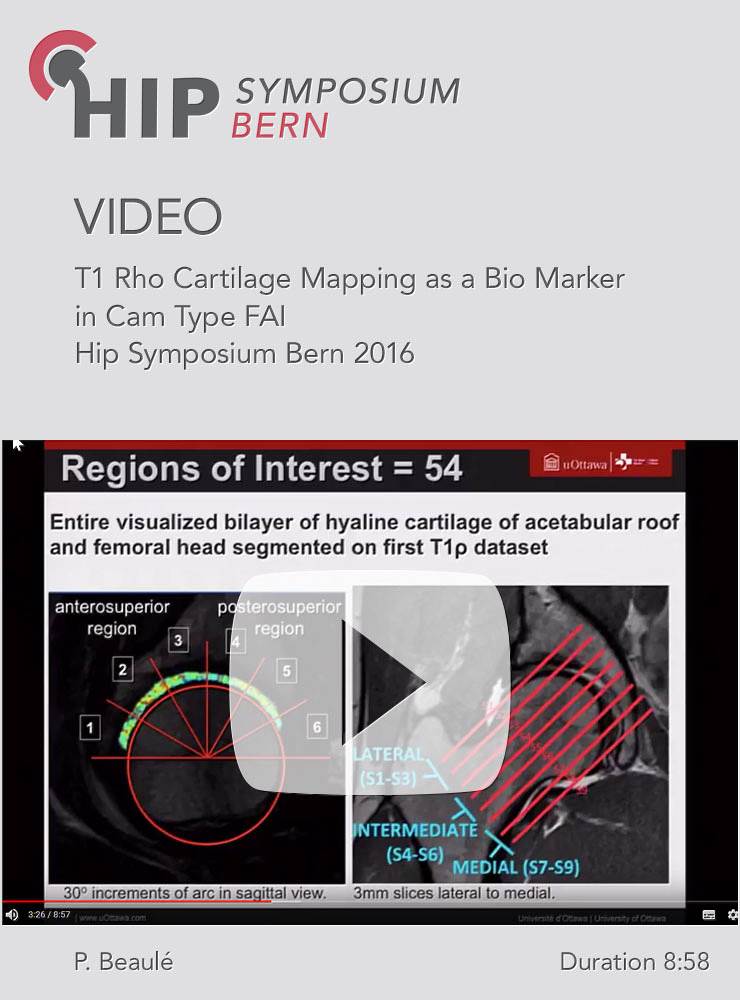P. Beaulé - T1 Rho Cartilage Mapping as a Bio Marker in Cam Type FAI - Hip Symposium 2016