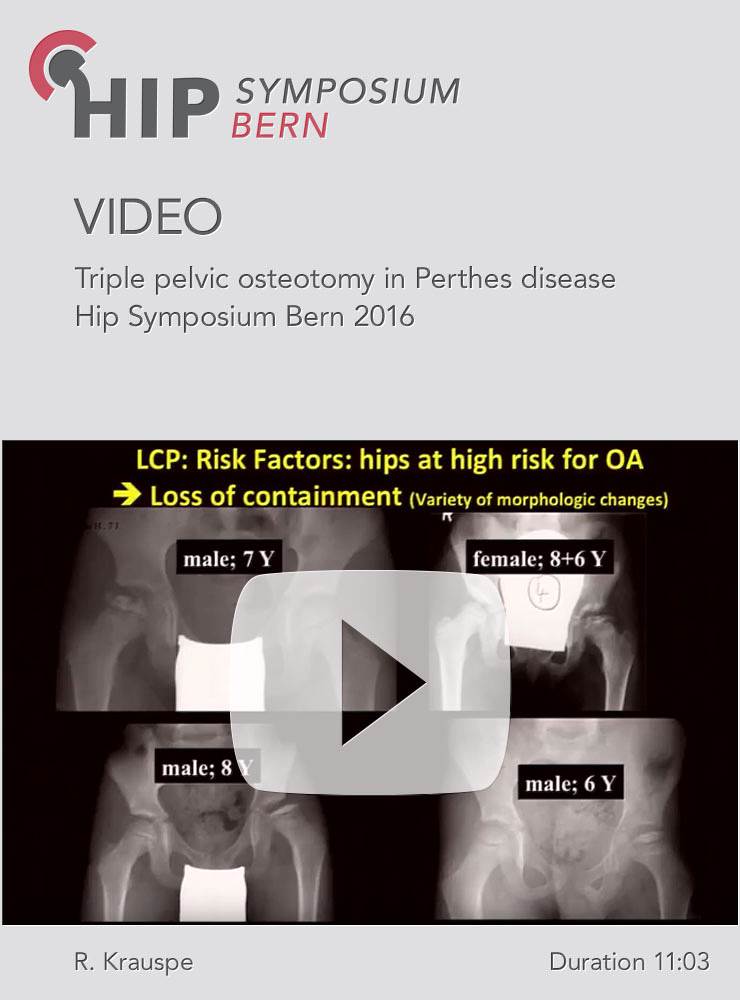 R. Krauspe - Triple pelvic osteotomy in Perthes disease - Hip Symposium 2016