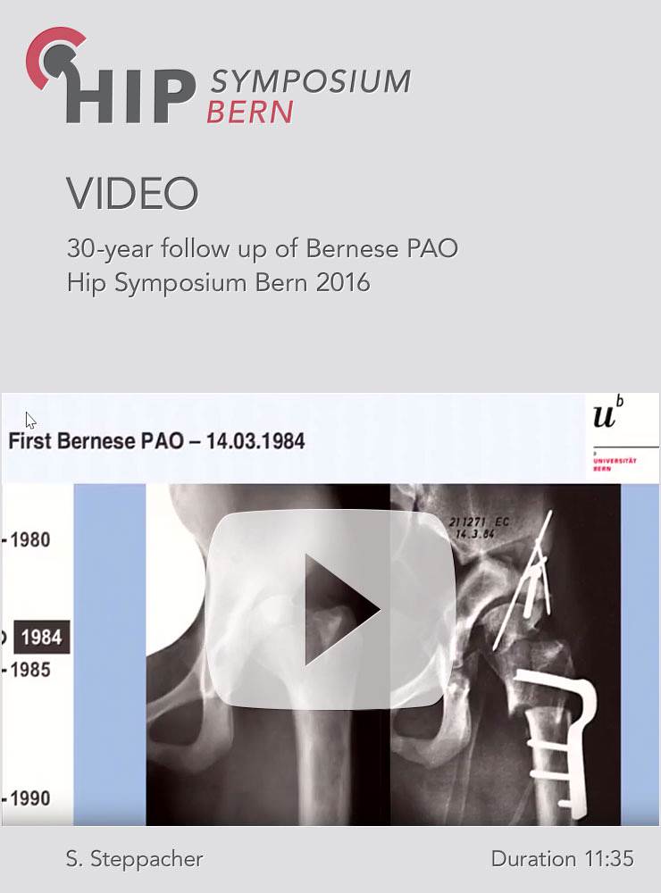 S. Steppacher - 30-year follow up of Bernese PAO - Hip Symposium 2016
