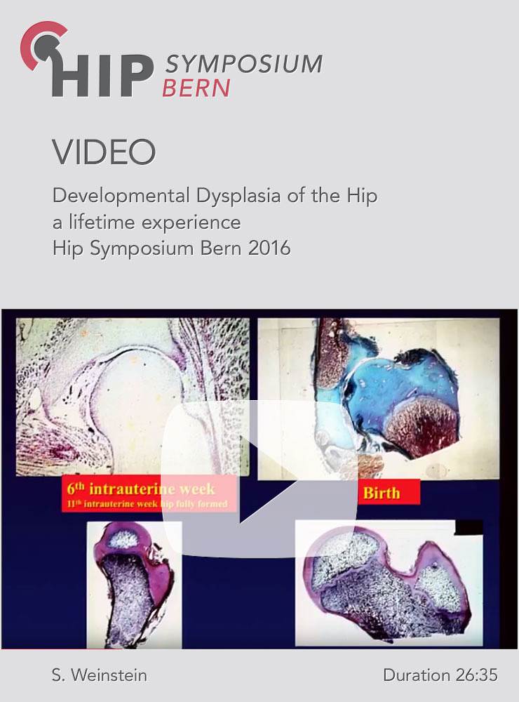 S. Weinstein - Developmental Dysplasia of the Hip a lifetime experience -  Hip Symposium 2016