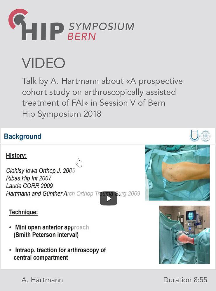 A. Hartmann - A prospective cohort study on arthroscopically treatment of FAI - Hip Symposium 2018