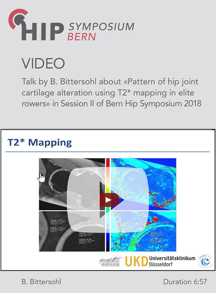 B. Bittersohl - Pattern of hip joint cartilage alteration using T2* mapping -  Hip Symposium 2018