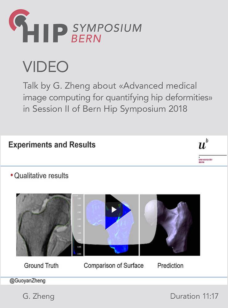 G. Zheng - Advanced medical image computing for quantifying hip deformities - Hip Symposium 2018