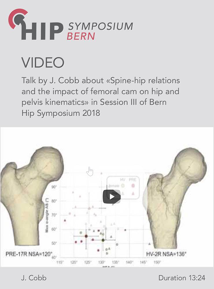 J. Cobb - Spine-hip relations and the impact of femoral cam on hip and pelvis kinematic - Hip Symposium 2018