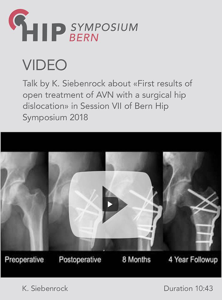 K. Siebenrock - First results of open treatment of AVN with a CHL - Hip Symposium 2018