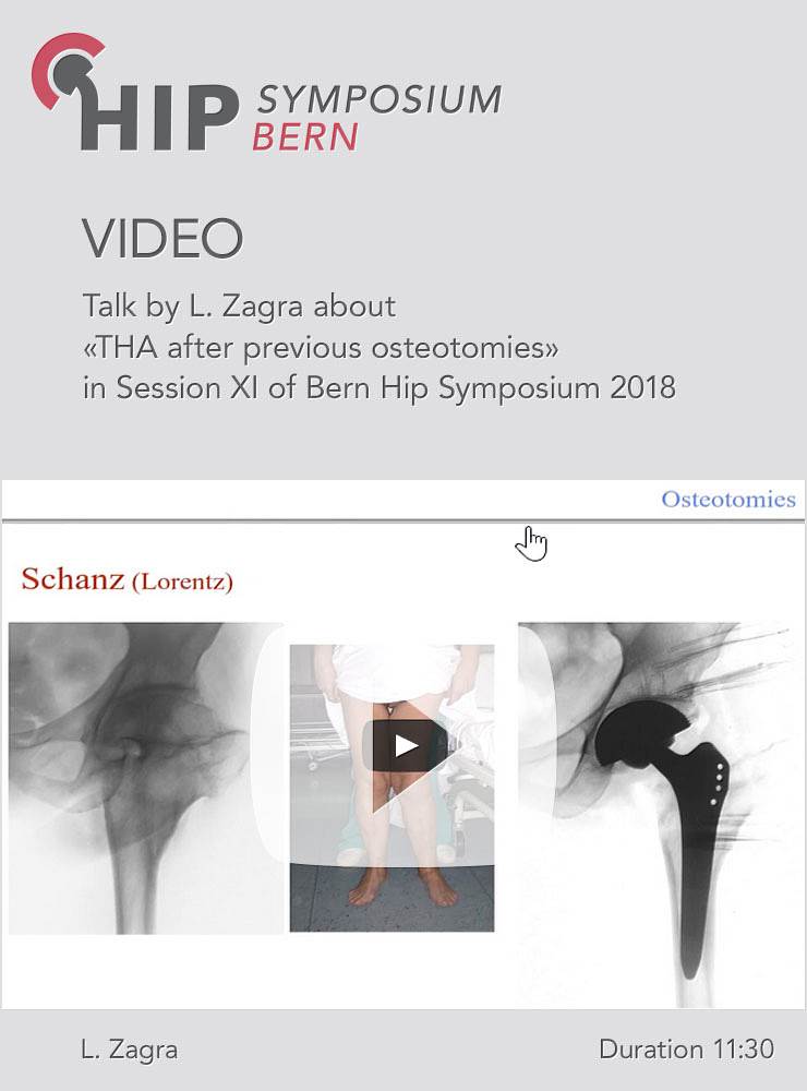 L. Zagra - THA after previous osteotomies - Hip Symposium 2018
