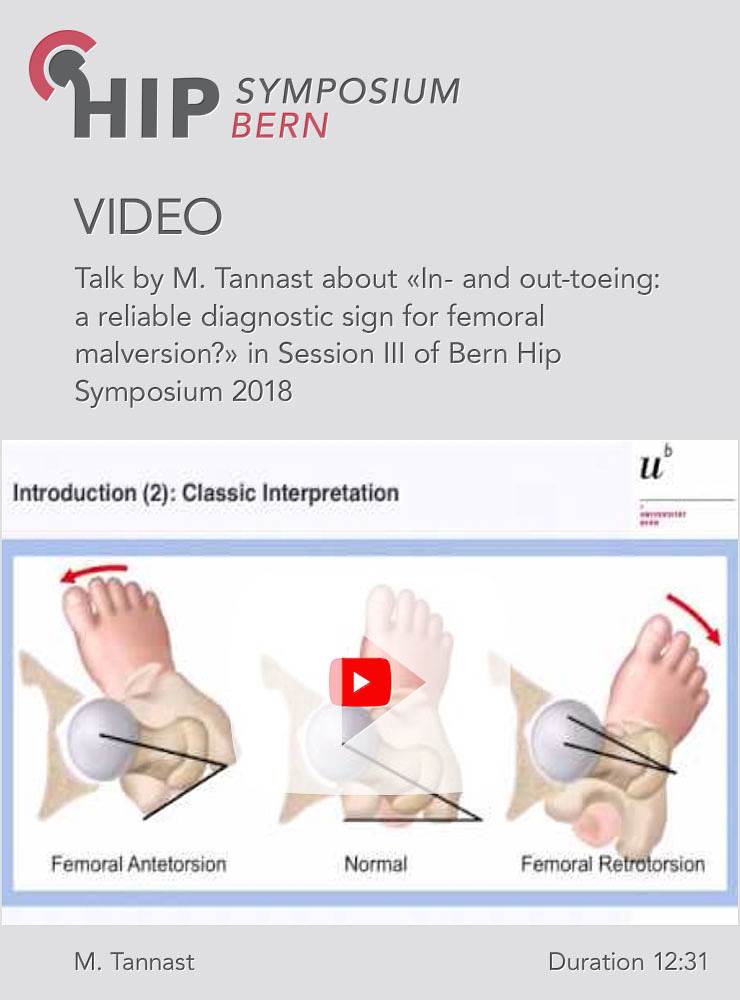 M. Tannast - In- & out-toeing: a reliable diagnostic sign for femoral malversion? - Hip Symposium 20