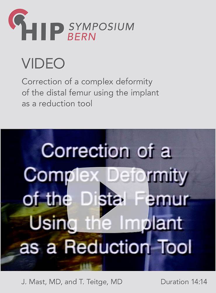 Correction of a complex deformity of the distal femur using the implant as a reduction tool