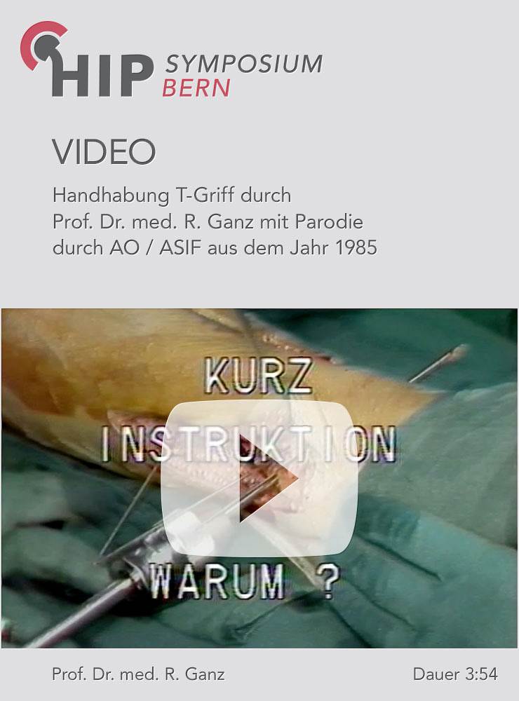 Handhabung neues Modell des T-Griffs durch Prof. Ganz