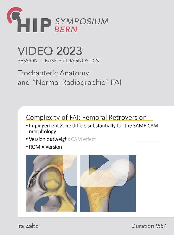 Trochanteric Anatomy and “Normal Radiographic” FAI | Ira Zaltz (Session 1)