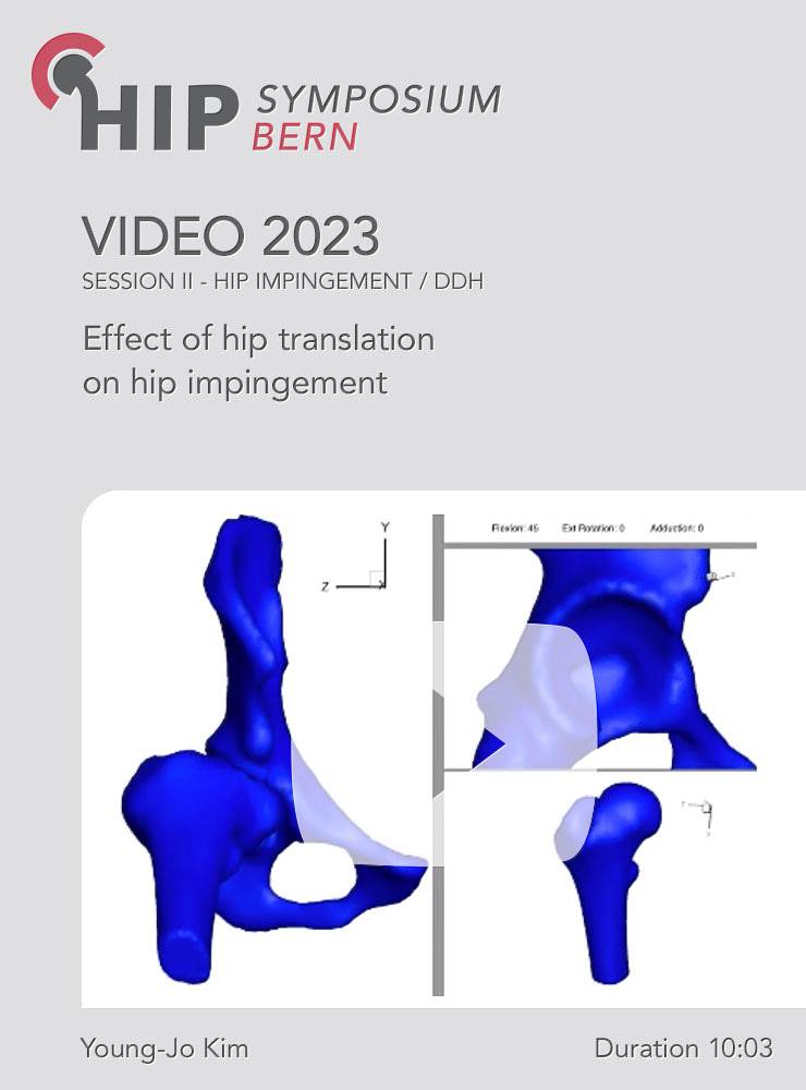 Effect of hip translation on hip impingement | Young-Jo Kim (Session 2)