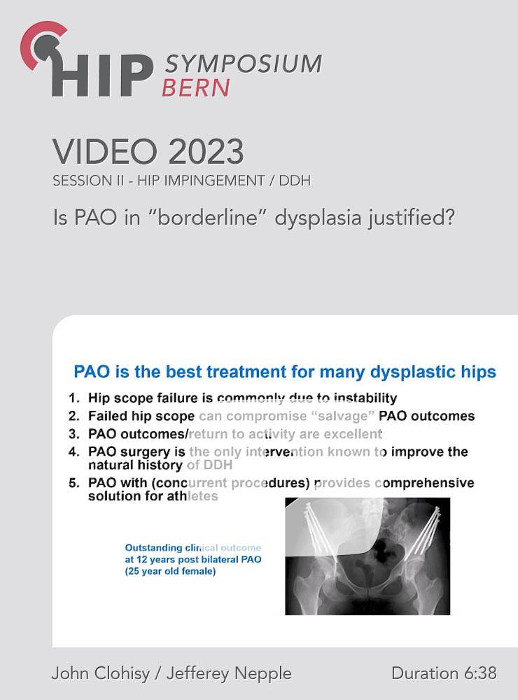 Is PAO in “borderline” dysplasia justified? | John Clohisy / Jefferey Nepple (Session 2)