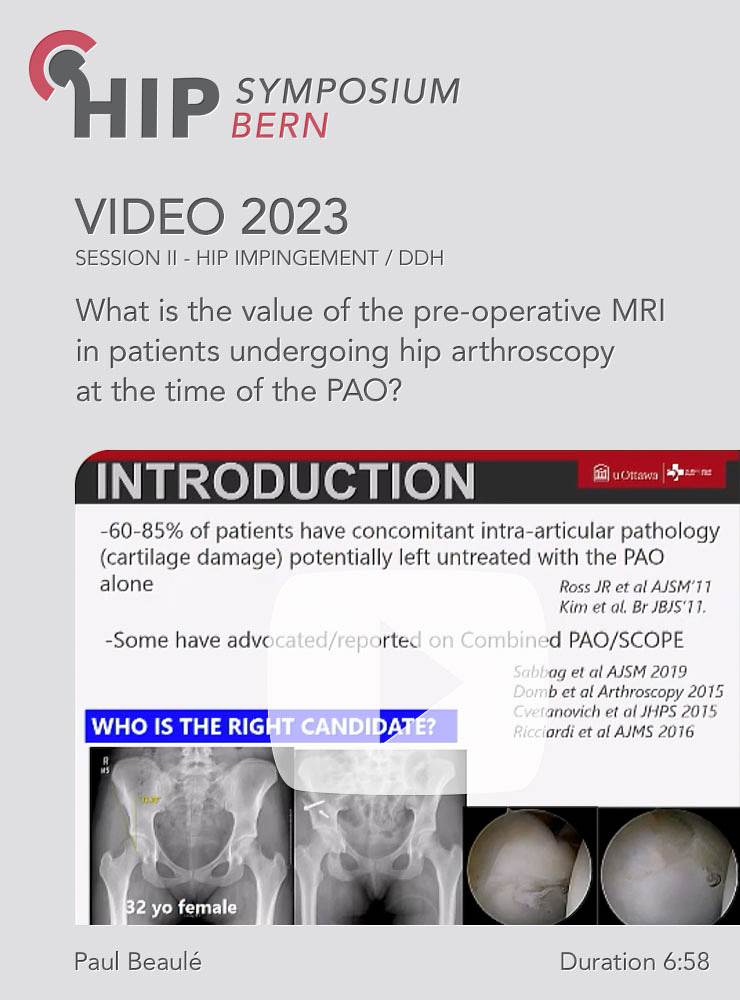 What is the value of the pre-operative MRI in patients undergoing hip arthroscopy at the time of the PAO? | Paul Beaulé (Session 2)