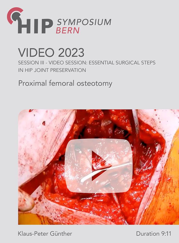 Proximal femoral osteotomy | Klaus-Peter Günther (Session 3)