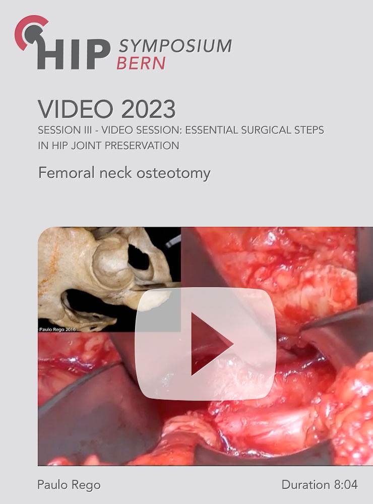 Femoral neck osteotomy | Paulo Rego (Session 3)