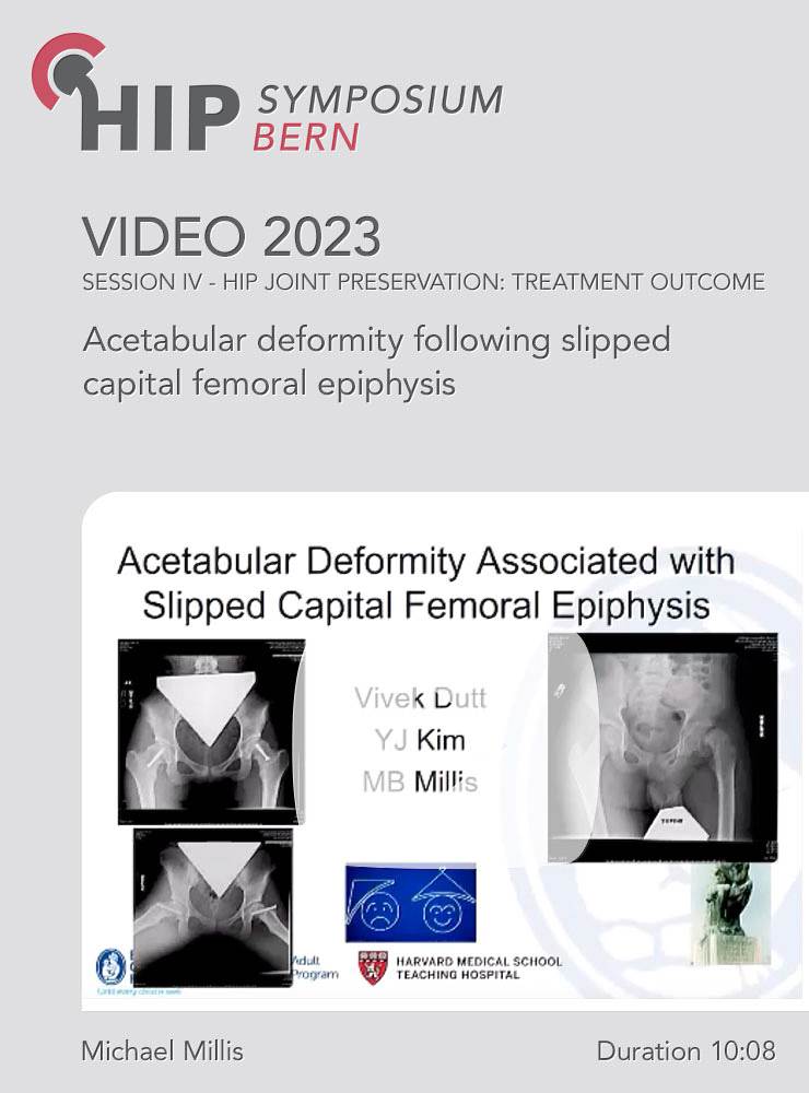 Acetabular deformity following slipped capital femoral epiphysis | Michael Millis (Session 7)
