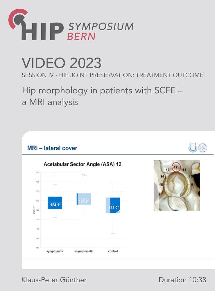 Hip morphology in patients with SCFE – a MRI analysis | Klaus-Peter Günther (Session 7)