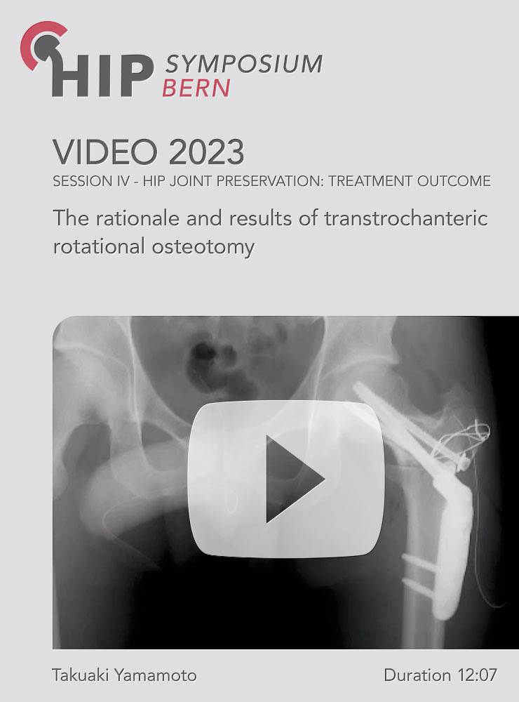 The rationale and results of transtrochanteric rotational osteotomy | Takuaki Yamamoto (Session 7)