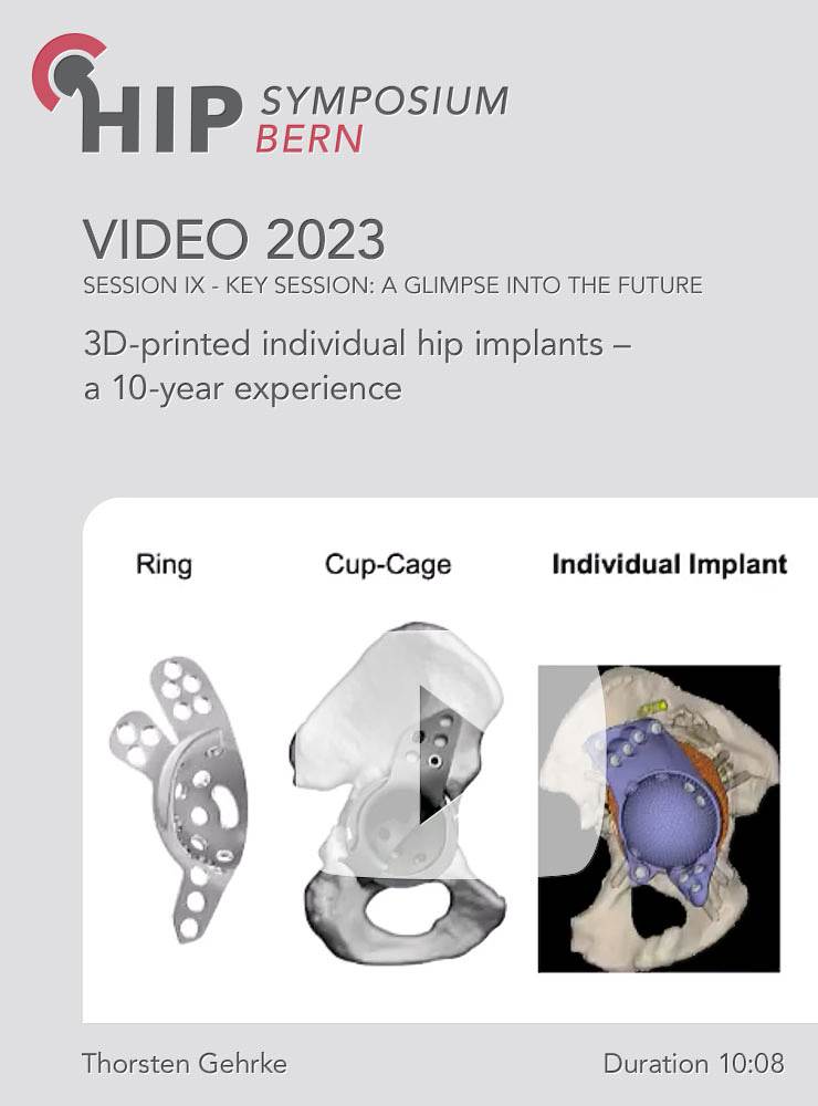 3D-printed individual hip implants – a 10-year experience | Thorsten Gehrke (Session 9)