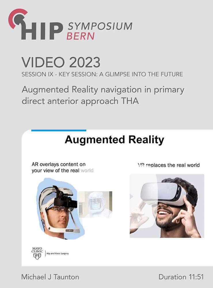 Augmented Reality navigation in primary direct anterior approach THA | Michael J Taunton (Session 9)