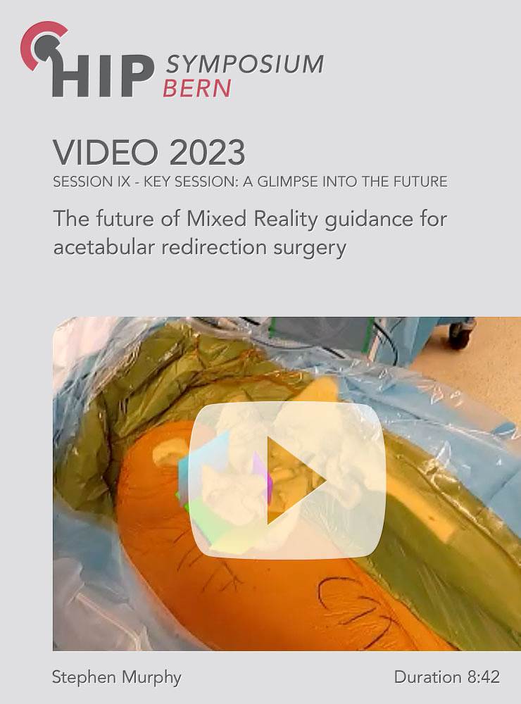 The future of Mixed Reality guidance for acetabular redirection surgery | Stephen Murphy (Session 9)