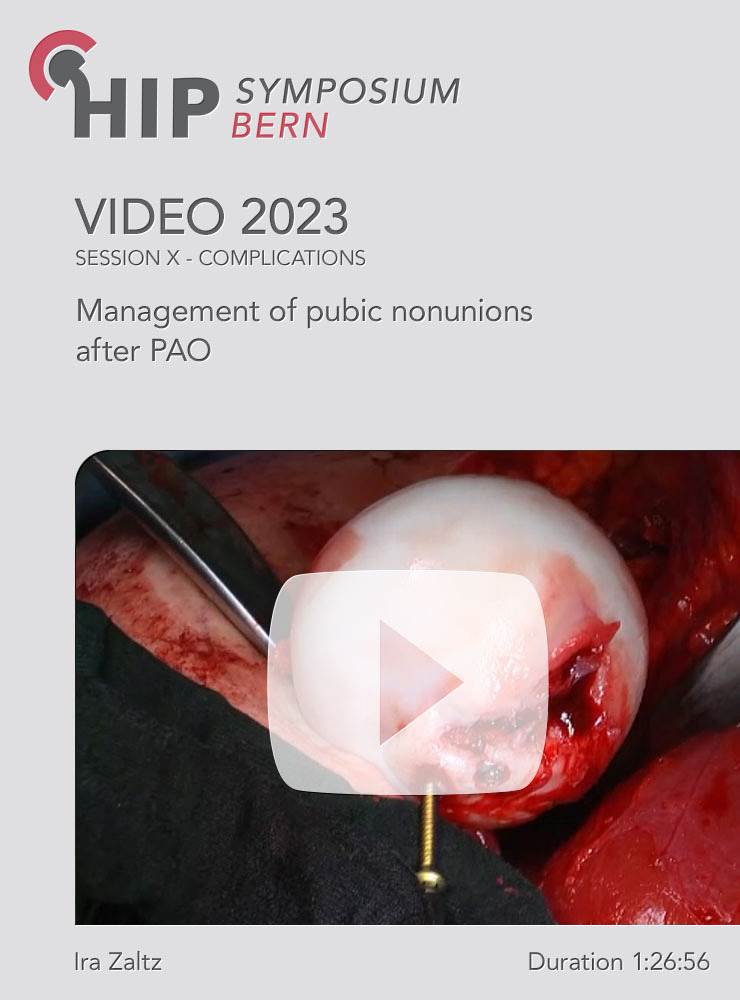 Management of pubic nonunions after PAO | Zaltz Ira (Session 10)