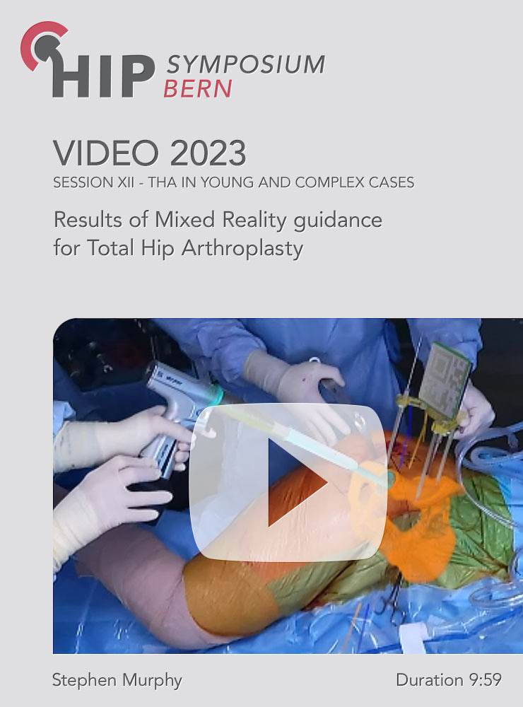 Results of Mixed Reality guidance for Total Hip Arthroplasty | Murphy Stephen (Session 12)