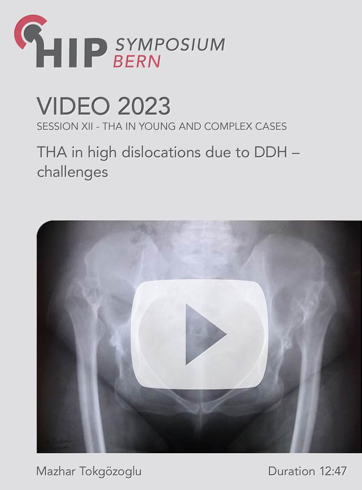 THA in high dislocations due to DDH – challenges | Tokgözoglu A. Mazhar (Session 12)