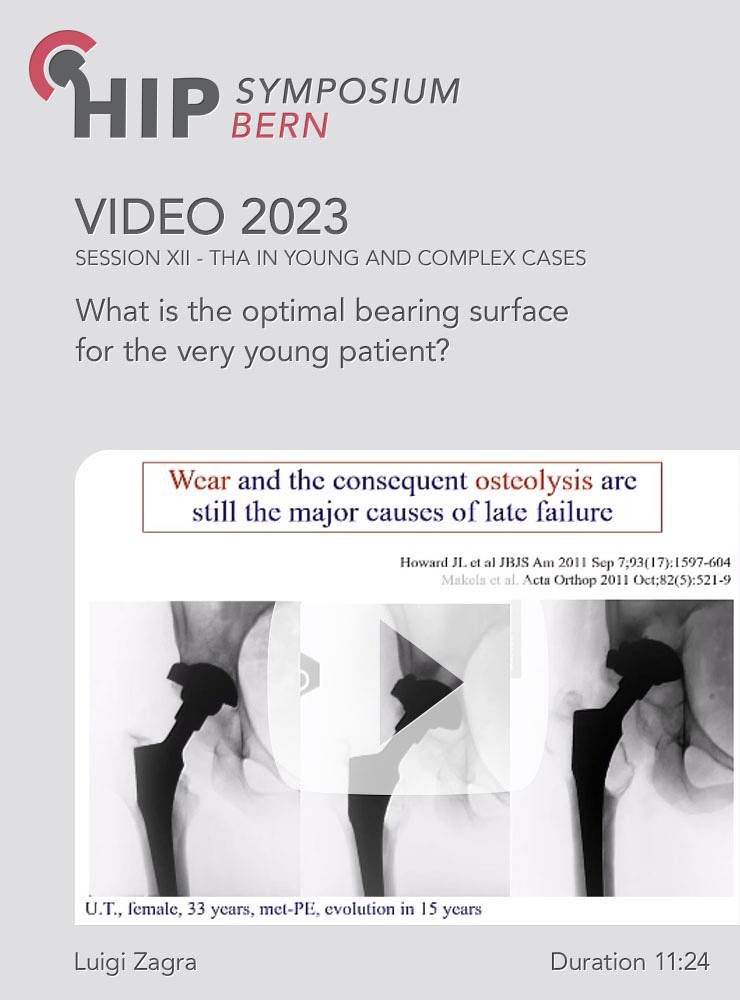 What is the optimal bearing surface for the very young patient? | Zagra Luigi (Session 12)