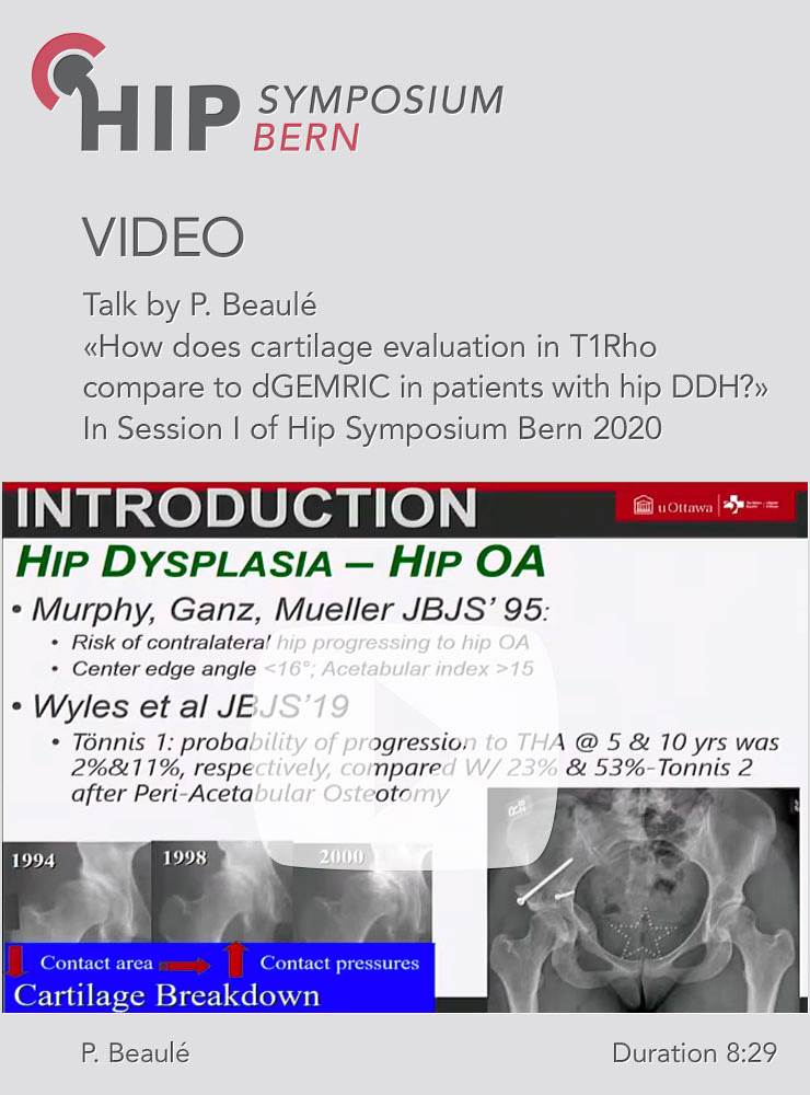 How does cartilage evaluation in T1Rho compare to dGEMRIC in patients with hip DDH? / Paul Beaulé
