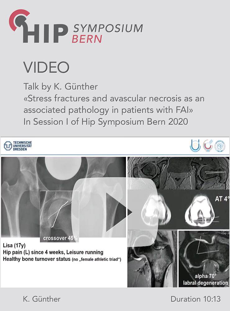 Stress fractures and avascular necrosis as an associated pathology in patients with FAI / K. Günther