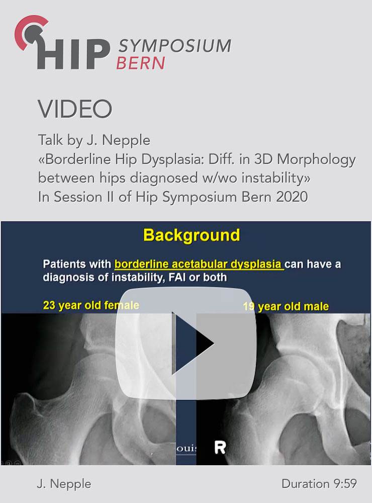 Borderline Hip Dysplasia: Differences in 3D Morphology between hips diganosed with and without instability / J. Nepple