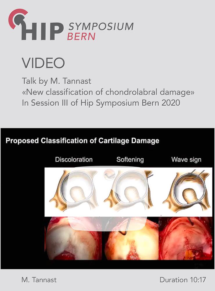 New classification of chondrolabral damage / M. Tannast