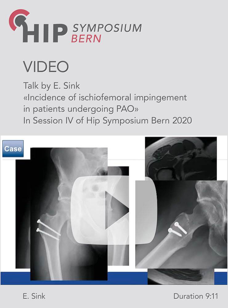 Incidence of ischiofemoral impingement in patients undergoing PAO / E. Sink