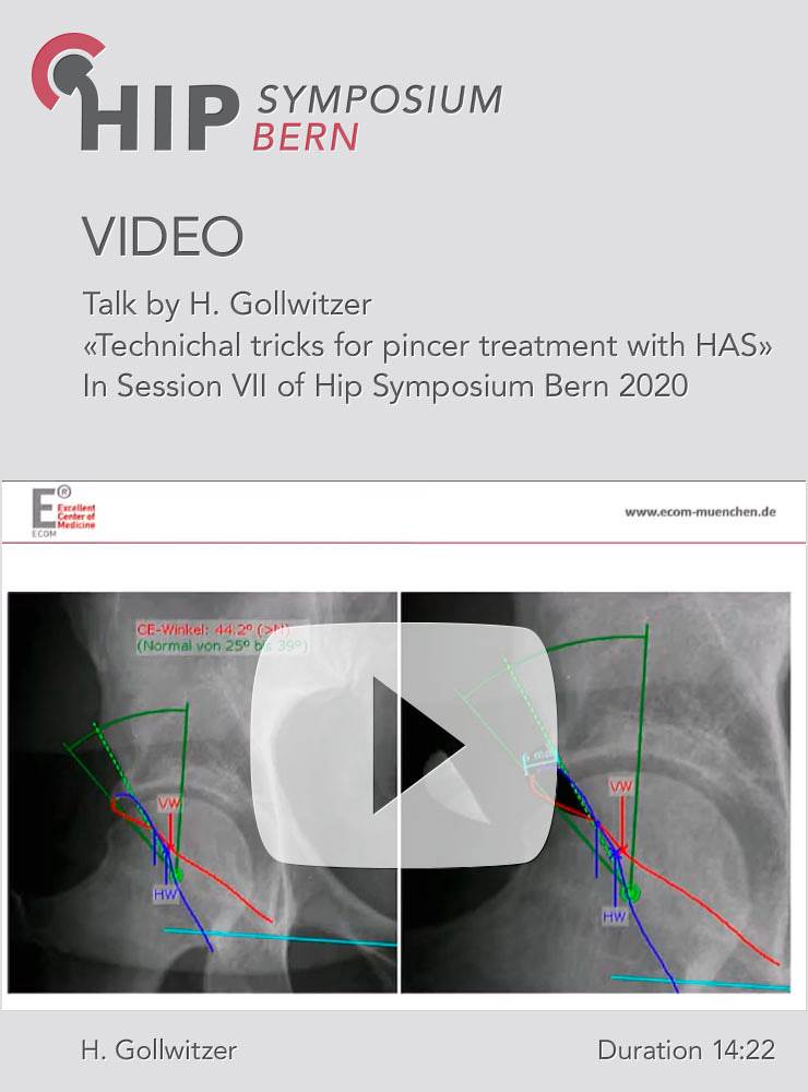 Technical tricks for pincer treatment with HAS / H. Gollwitzer